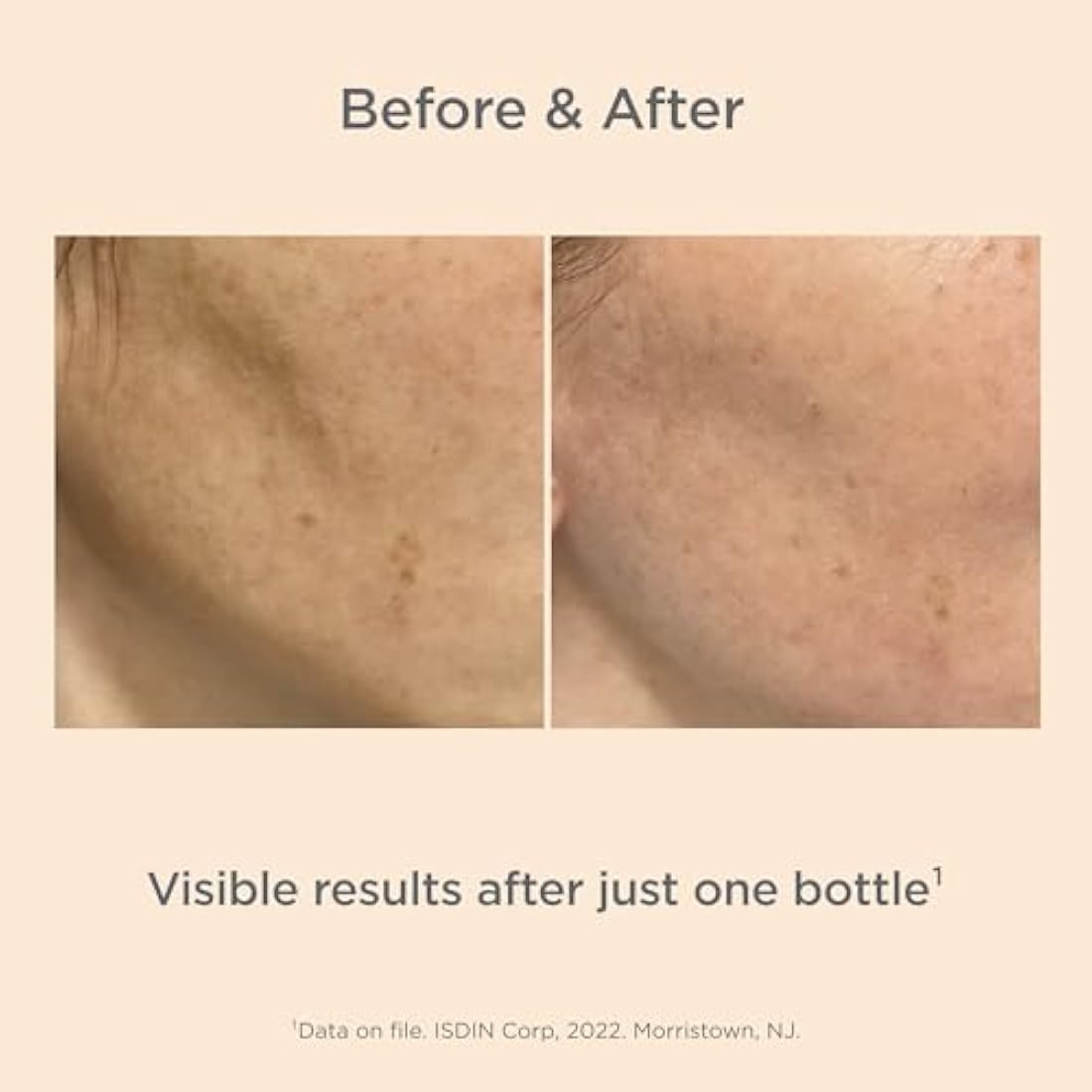 ISDIN Isdinceutics Melaclear, Anti-Spot Facial Serum, 71% Reduction of Spots and Visible Results in 14 days, 30 ml