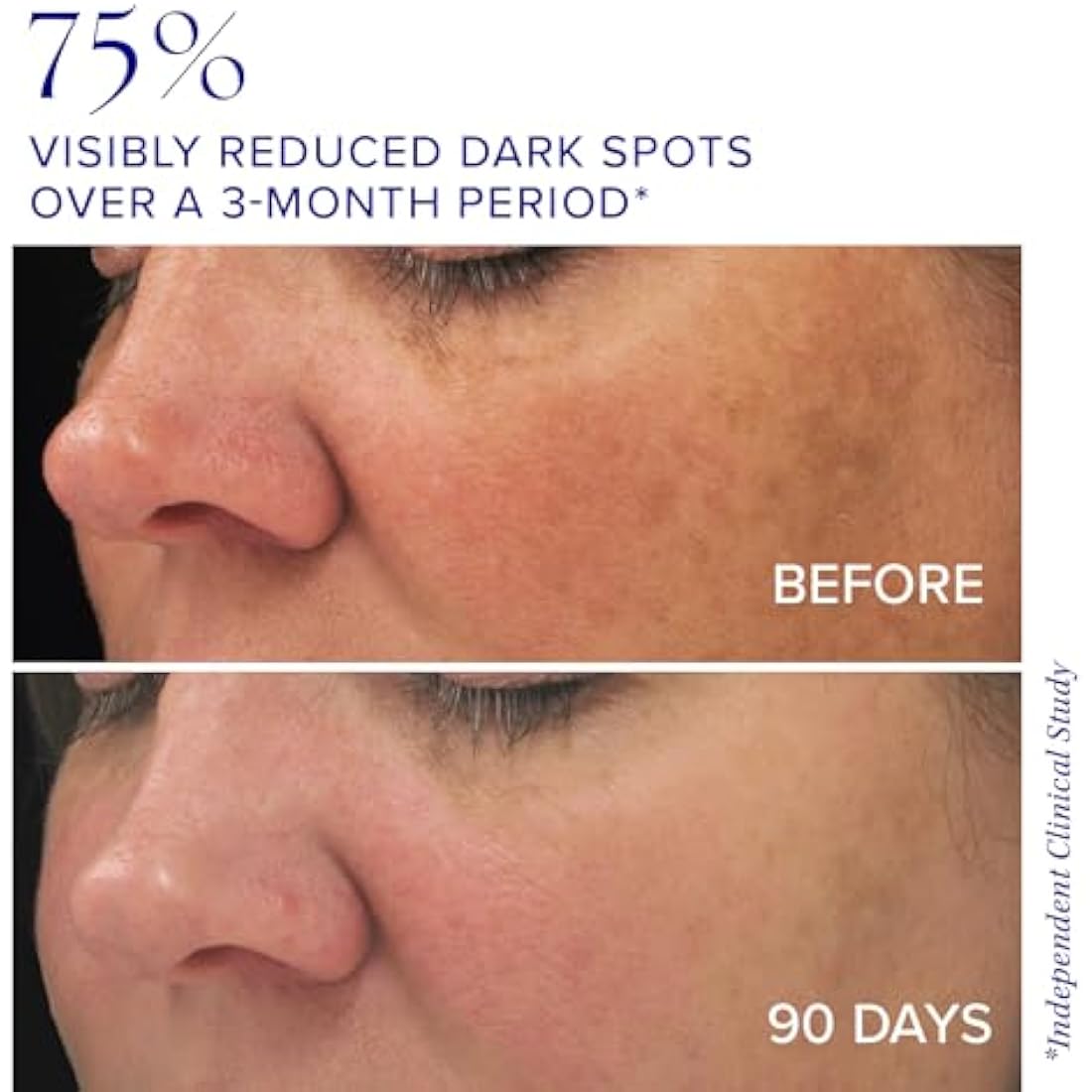 iS CLINICAL Brightening Complex - Skin Brightening Complex, Addresses Age Spots