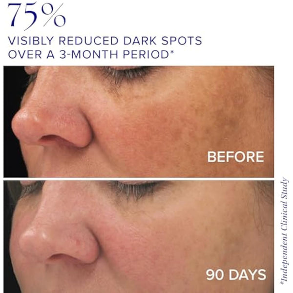 iS CLINICAL Brightening Complex - Skin Brightening Complex, Addresses Age Spots