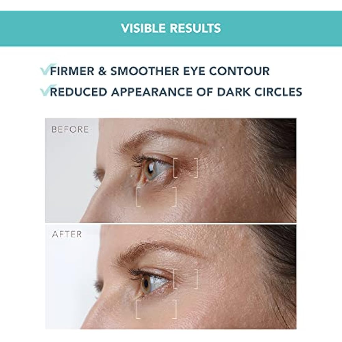 FOREO IRIS Firming Eye Serum - Retinol Serum- Mushroom Extract - Bakuchiol - Eye Cream for Dark Circles and Puffy Eyes - Dark Circles Under Eye Treatment - Travel size - 15ml