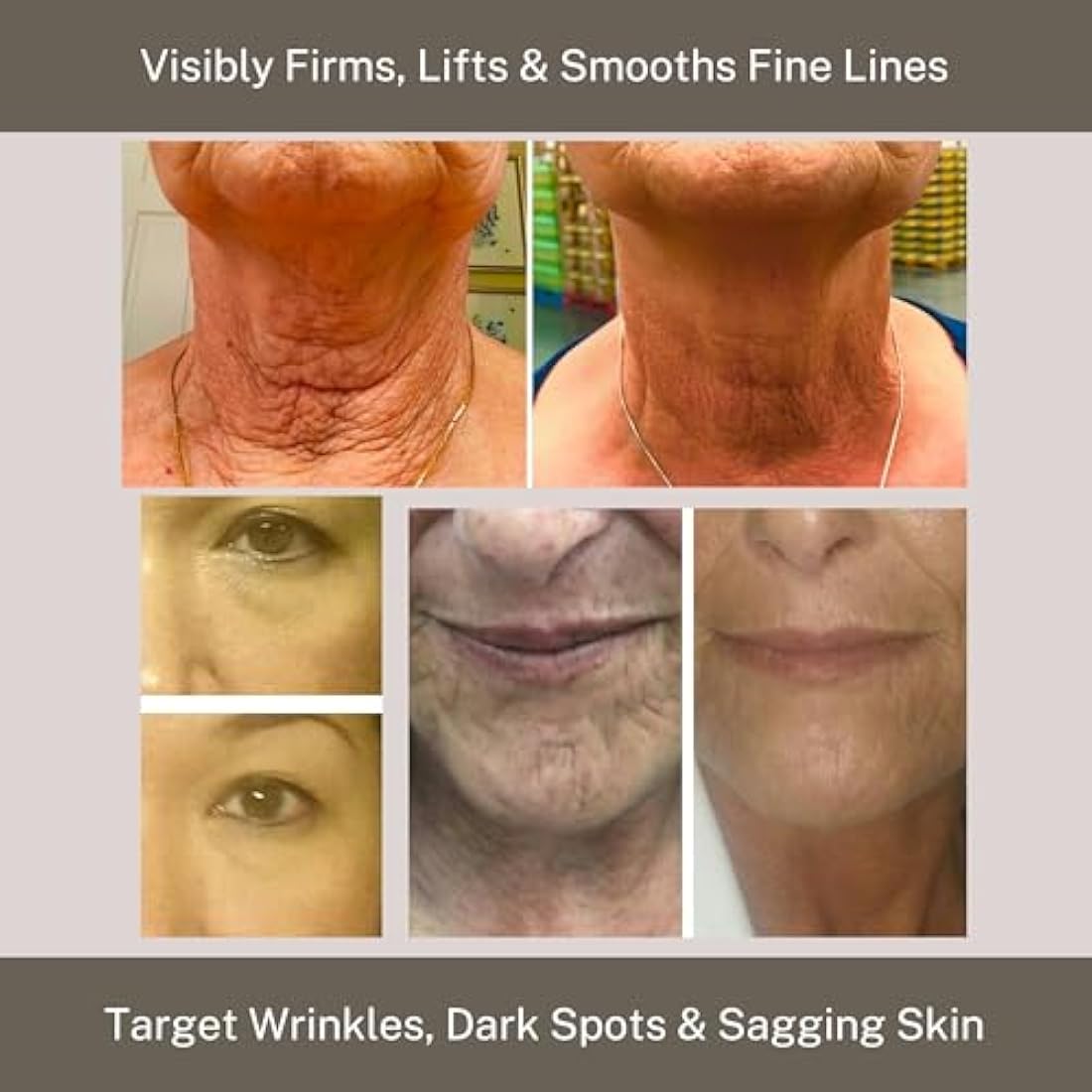 InfiniteAloe Gold Anti-Aging Moisturizer Formula - Organic Aloe Supported by Twelve Key Anti-Aging Ingredients to Deliver Younger Looking, Hydrated, Soft Skin (1.7 Oz.)