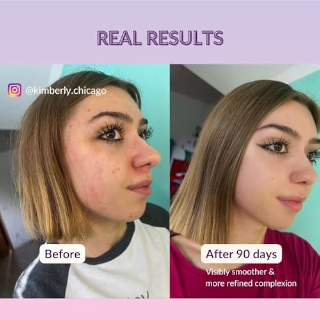 High Strength Retinol Serum - 2,5% Retinol Anti-Ageing Formula with Hyaluronic Acid and Witch Hazel - 30ml - Intensive Face Care against Wrinkles and Age Spots