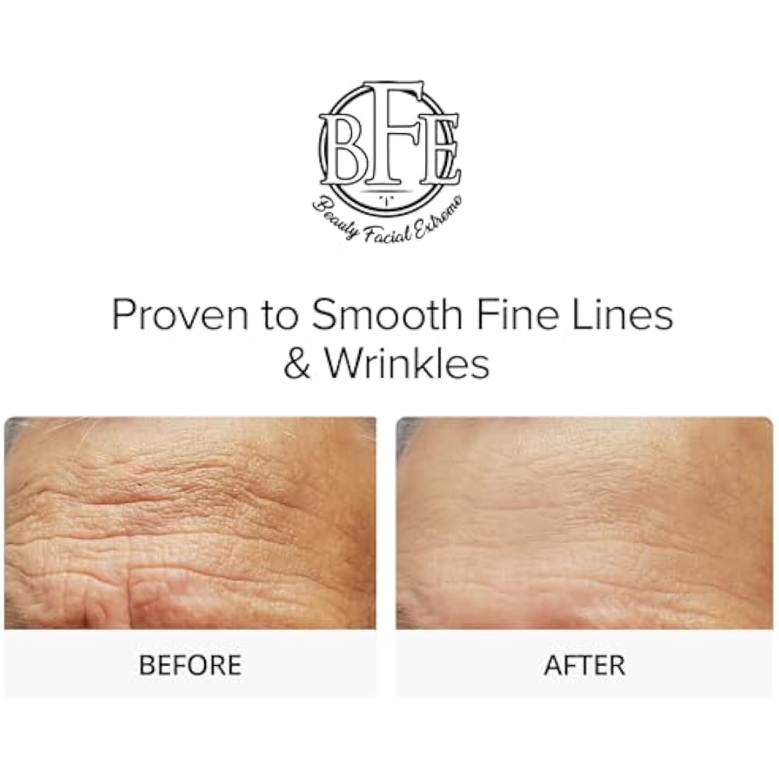 Glycolic Acid 15% Anti-Wrinkle Cream- Extra strength Alpha Hydroxy Acid Enhanced with Green Tea Extract. Improves Complexion & Smooths Out Fine Lines & Wrinkles.