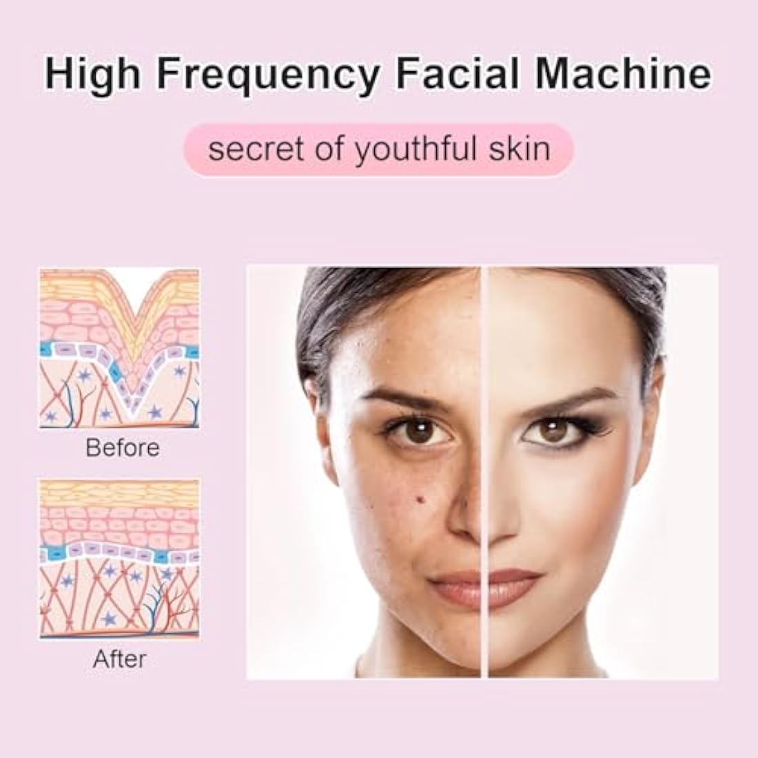 Yofuly High F-requency Face Wand with 4 Violet Beauty Stabs, Portable High F-requency Facial Machine, Professional Skin Tightening Machine for Facial Beauty, Face Device for Skin Care Home Salon Use