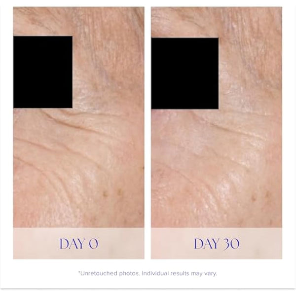 iS CLINICAL Youth Eye Complex, Anti-Aging Brightening Under Eye Cream, Reduces Puffiness, Hydrating and Firming Eye Cream