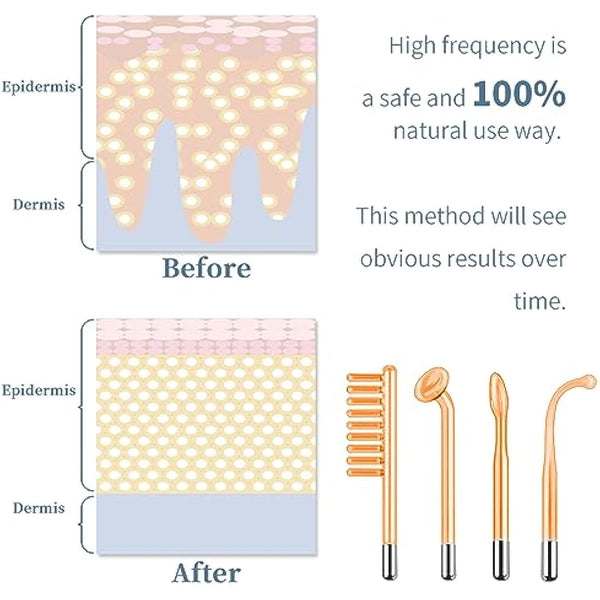 High Frequency Facial Machine, TUMAKOU Professional Portable Handheld Neon HF Face Wand, Light Therapy Facial Skin Tightening Machine Device with 4 Different Tubes