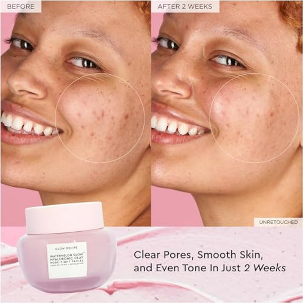 Glow Recipe Watermelon Glow Hyaluronic Clay Pore-Tight Facial - Gentle Exfoliating Clay Mask with Hyaluronic Acid - Help Minimize the Appearance of Pores, Even Tone + Hydrate (60ml / 2oz)