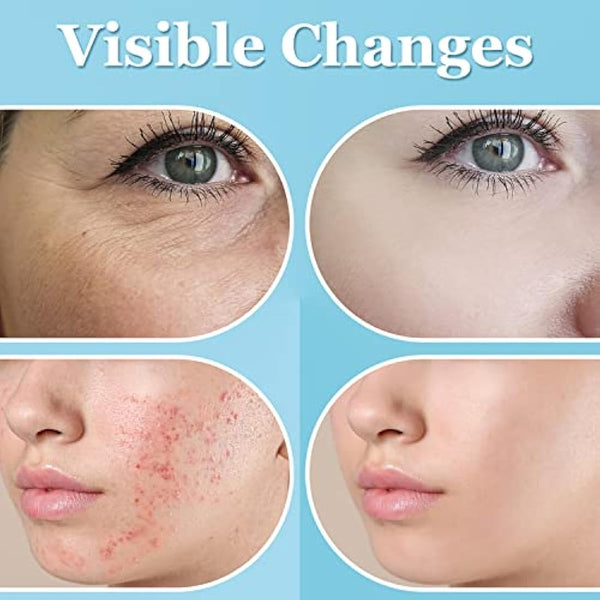 High Frequency Wand - UUPAS High Frequency Facial Wand with 6 Different Neon Tubes for Face/Hair/Body - Home Use Skin Tightening Machine Device for Acne Firming Skin Rejuvenation Wrinkle Removal