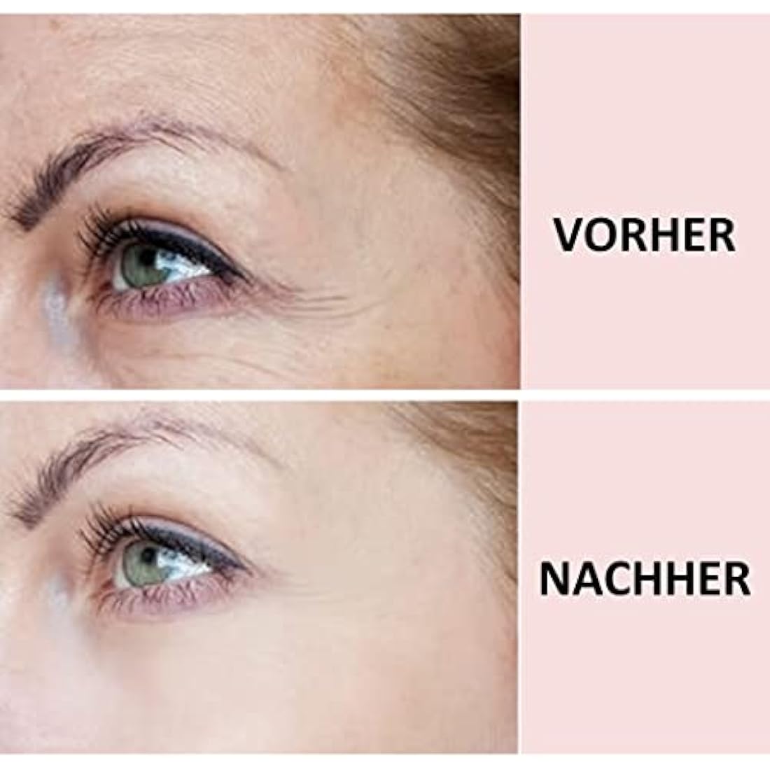 2-in-1 Sandy Skin® | 2x Forehead Pad & 1x Eye Pads | Forehead Pad | Eye Pads Wrinkle Reduction | Wrinkle Wrinkle | Forehead Wrinkle Pads | Forehead Wrinkle Reduction | Forehead Pads Against Wrinkles