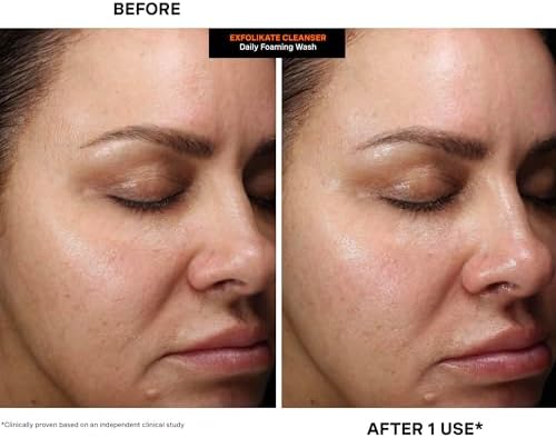 Kate Somerville ExfoliKate Cleanser, Daily Exfoliating Face Wash, Foaming Face Wash with Glycolic Acid and Lactic Acid, Gentle Facial Scrub