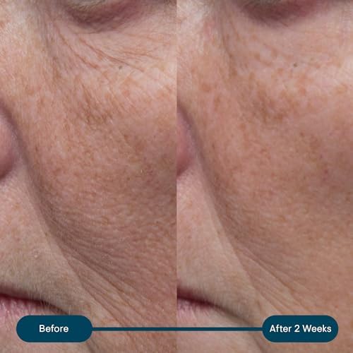 ELEMIS Pro-Collagen Marine Cream SPF30 – Anti-Wrinkle Face Moisturiser, Hydrating Day Cream, 50ml – Original, Ultra-Rich or Rose