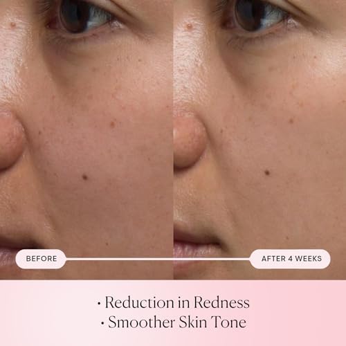 Elemis Pro-Collagen Serums – Renewal, Super Elixir & Rose Micro Serum for Smoother, Firmer, Radiant Skin (15ml & 30ml Anti-Aging Skincare)