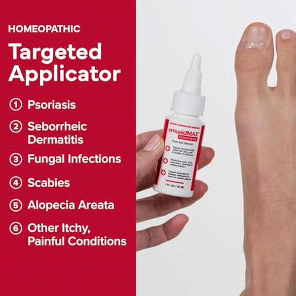 EMUAIDMAX Concentrate Homeopathic First Aid Serum, All Natural Solution for Itchy, Painful Skin Conditions, Targets Psoriasis, Eczema, Folliculitis, Nail Fungus, Seborrheic Dermatitis, 1 oz