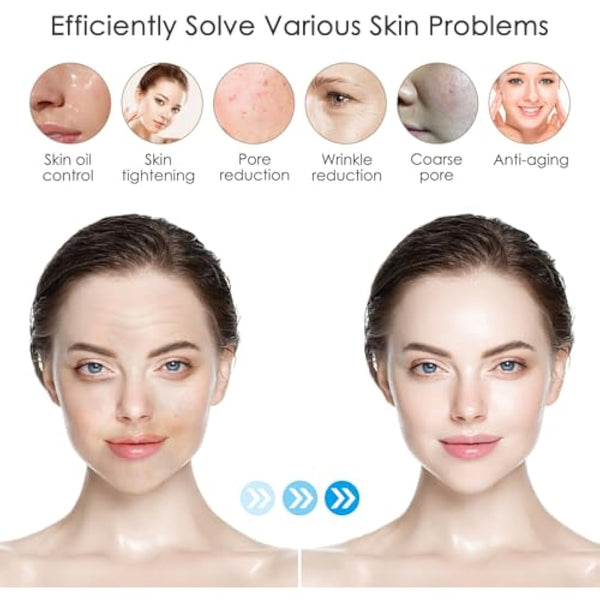 Dr.pen M8S Cartridges Nano-S, 20Pcs Dr.pen Cartridges for Microneedling Pen M8S/A8S/A9 Model, Authentic Disposable Microneedling Cartridges (Nano-S, 20Pcs)