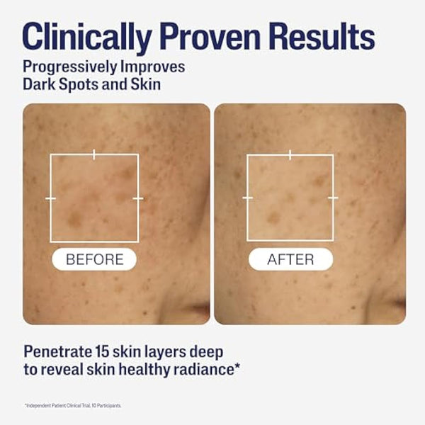 Cetaphil Healthy Radiance Brightening Serum with Niacinamide for Skin Pigmentation, 30ml