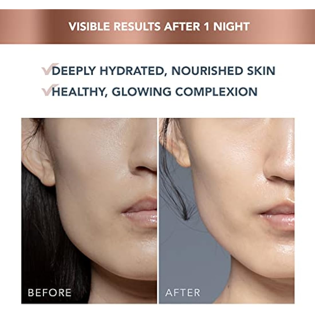 FOREO SUPERCHARGED Overnight Mask - Night Cream - Face Moisturiser - Rejuvenating Face Care - Overnight Face Cream - Hyaluronic Acid & Vitamin E - Vegan - Cruelty & Gluten-Free - Eco-Friendly - 75ml