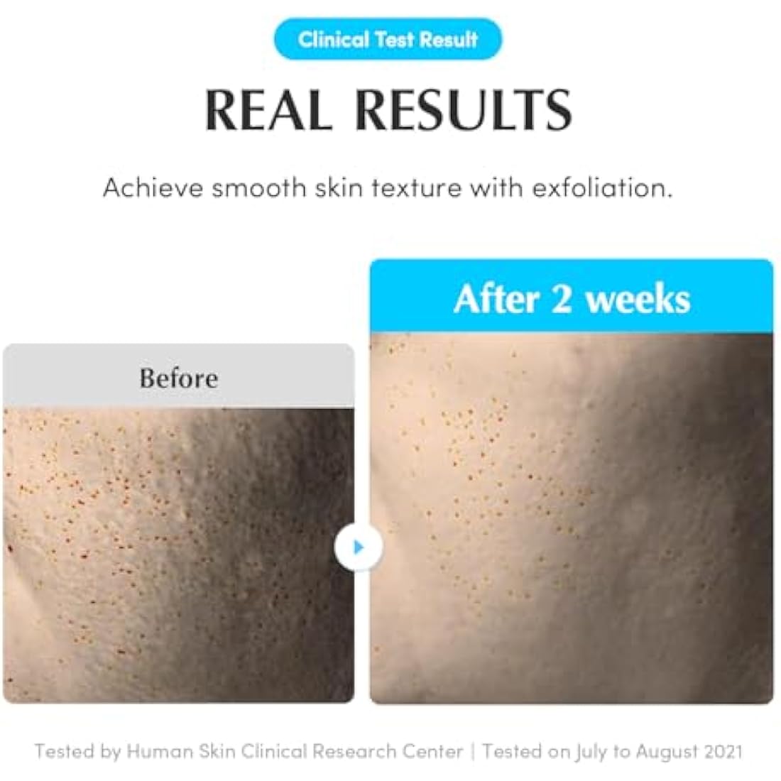 EQQUALBERRY Swimming Pool Face Toner 300ml Moisturising and Soothing Facial Toner for Face, Pore Control and Gentle Exfoliation, Suitable for Dry to Oily Skin