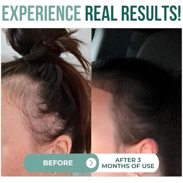 100% Organic, Raw Batana oil for Hair Growth | Natural Cold Press Extraction Method | Dr Sebi Scalp Care Hair Shine treatment for Men & Women | No Burnt Smell