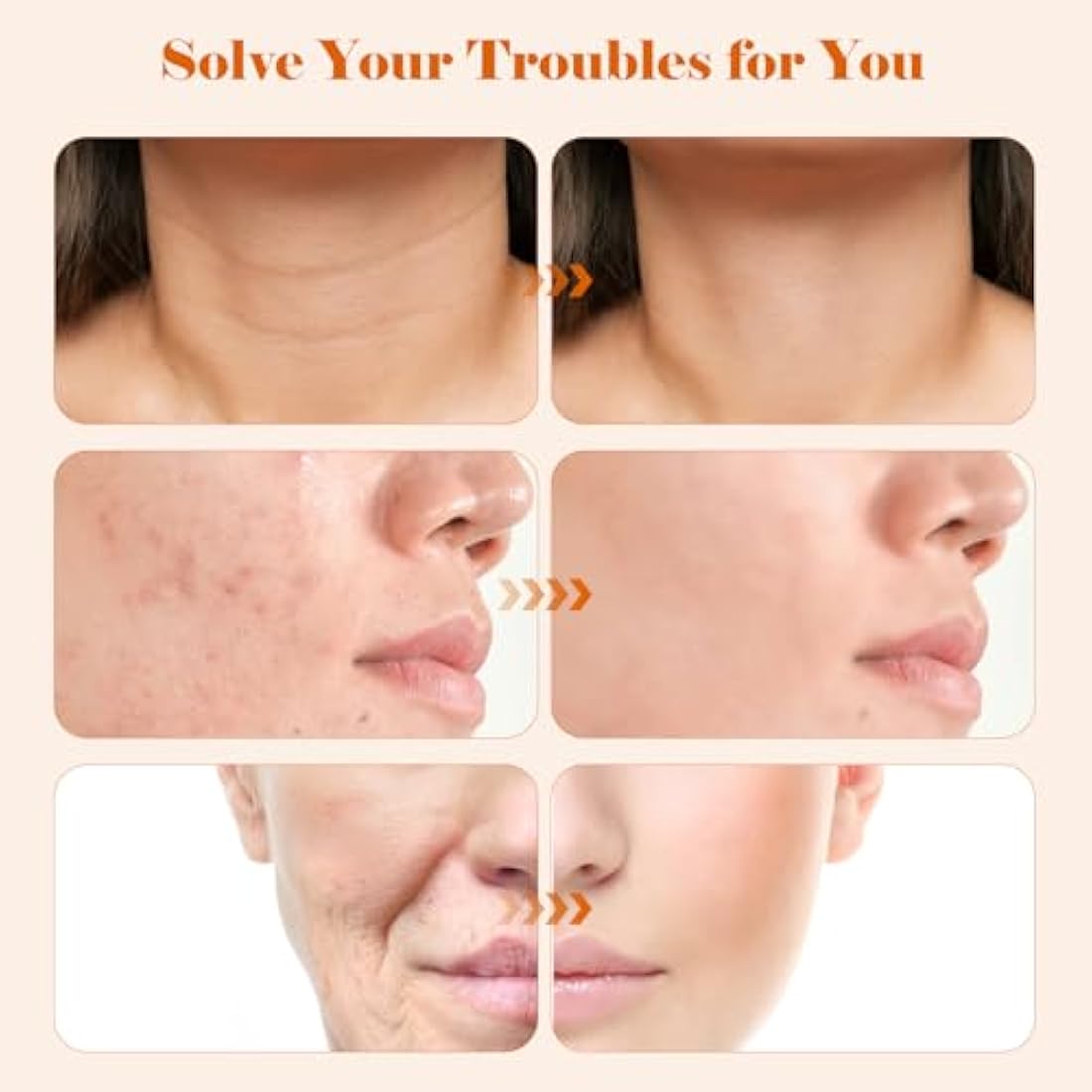 High F-requency Wand for Hair Growth, iklestar 6 PCS High F-requency Facial Machine Kit for Skin Care Home Salon Use