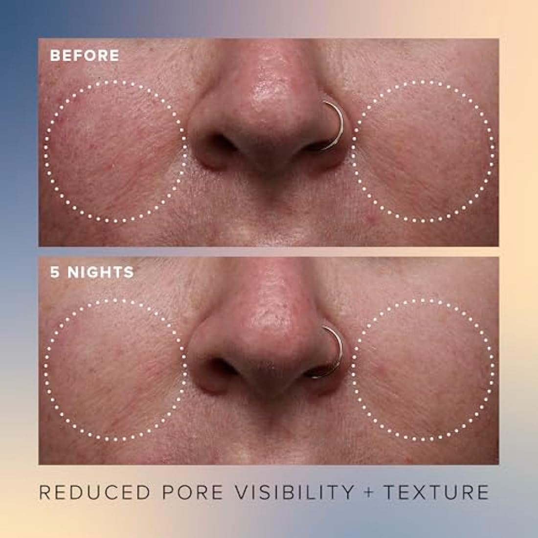 Farmacy Honey Glow 17% AHA & BHA Resurfacing Night Serum - Facial Serum with Hyaluronic Acid - Reduces Fine Lines & Pores(30ml)