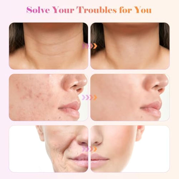 High F-requency Wand, iklestar High F-requency Facial Machine for Hair Growth with 6 Glass Tubes, Handheld Hair Wand Kit for Home Use