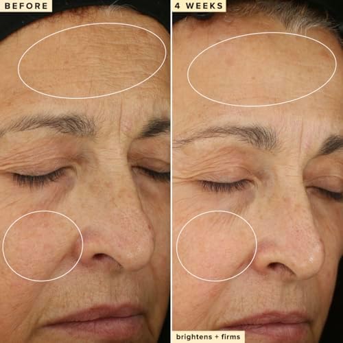 Farmacy 10% Vitamin C Serum for Face - Waterless - Dark Spot Remover for Face - Antioxidant with Ferulic Acid (30 ml)