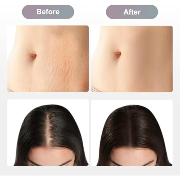 Dr.pen M8/M7S Cartridges 16 Pins, 10Pcs Dr.pen Replacement Cartridges for Microneedling Pen M8/M7S Model, Authentic Disposable Microneedling Cartridges (16 Pins, 10Pcs)