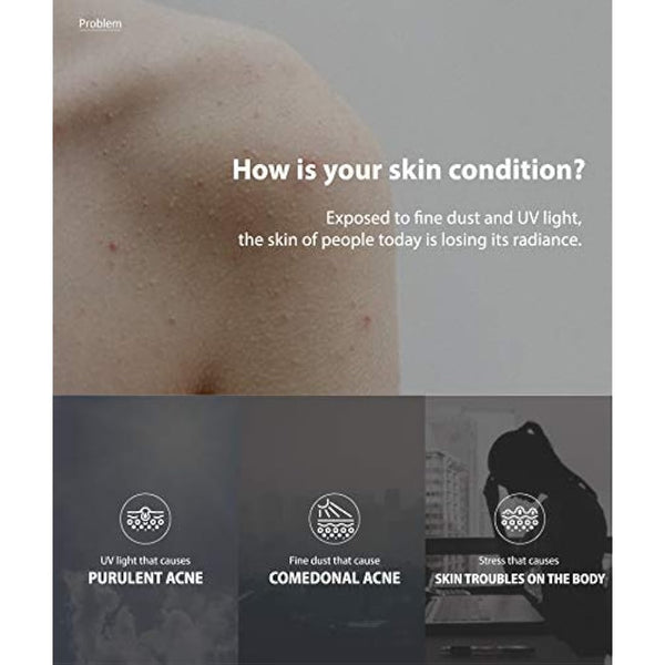 ANUA Heartleaf 77% Soothing Toner I pH 5.5 Skin Trouble Care, Calming Skin, Refreshing, Purifying (500ml / 16.9 fl.oz.)