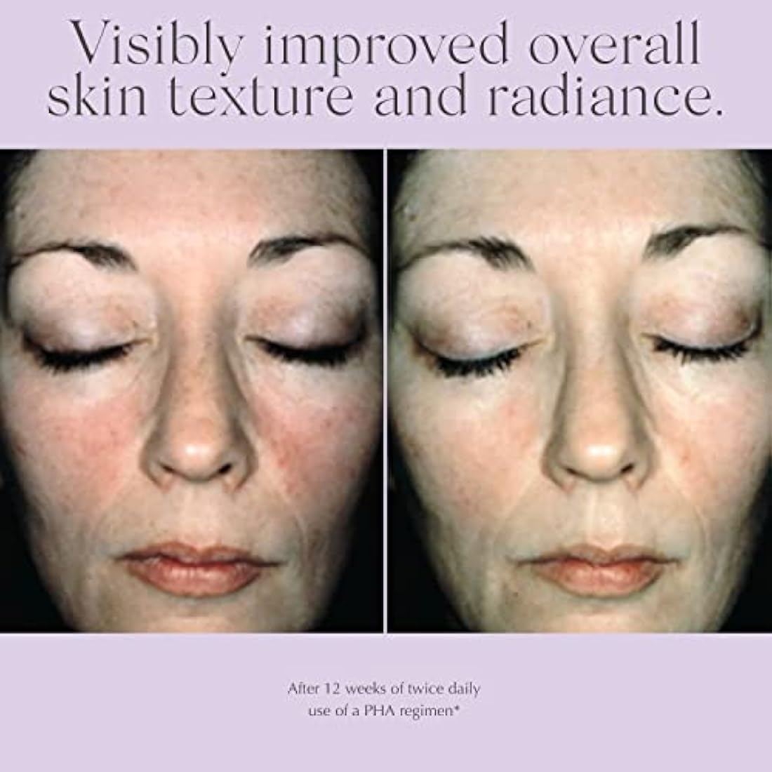 Exuviance Overnight Transformation Complex