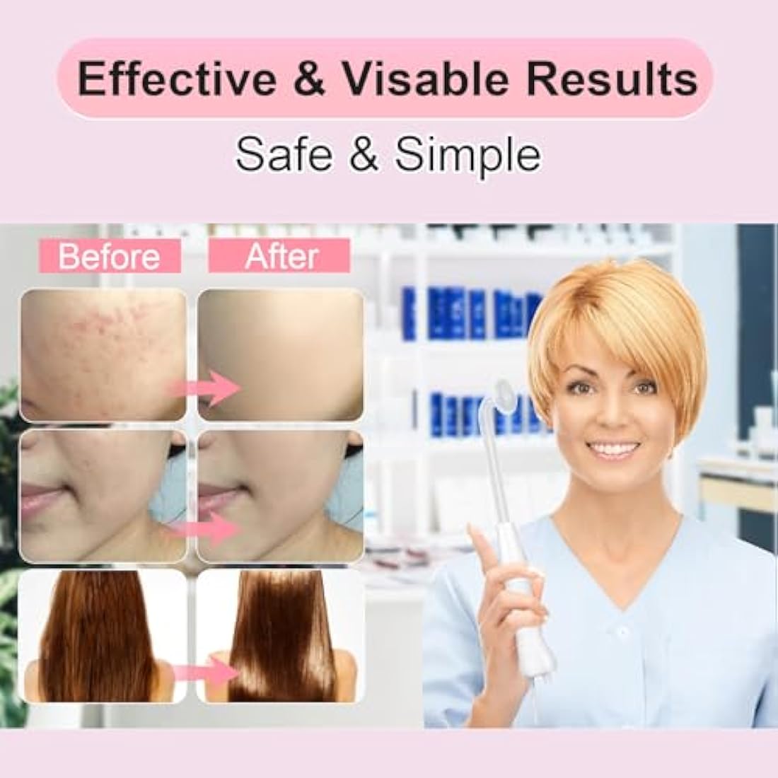 Yofuly High F-requency Face Wand with 4 Violet Beauty Stabs, Portable High F-requency Facial Machine, Professional Skin Tightening Machine for Facial Beauty, Face Device for Skin Care Home Salon Use