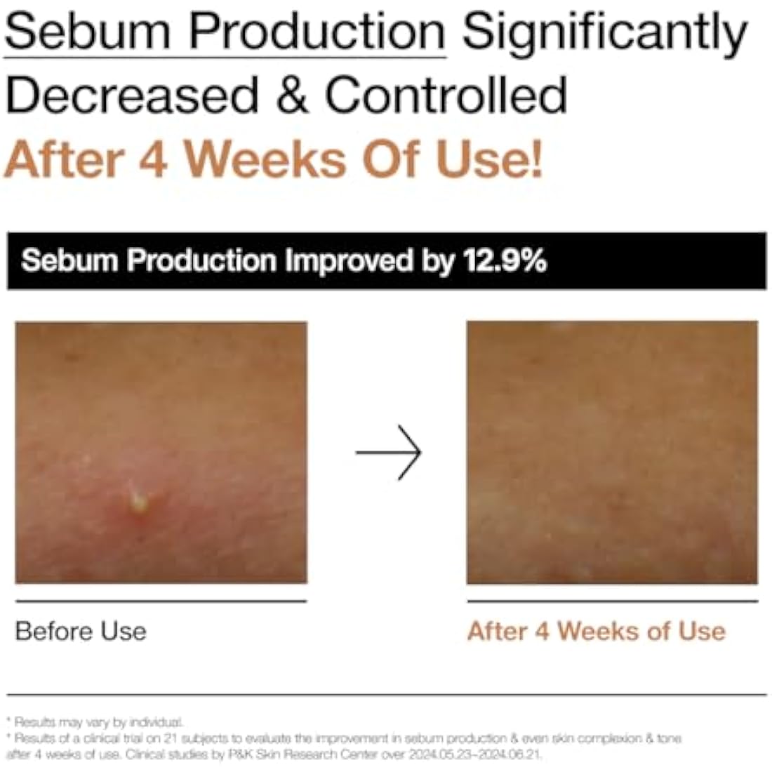 ANUA Rice 70 Glow Milky Toner (250 ml)