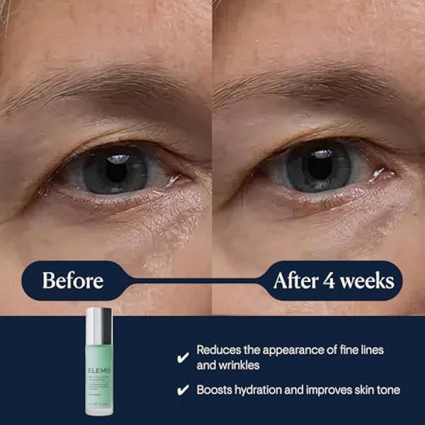 ELEMIS Pro-Collagen Tri-Acid Peel 30ml – Anti-Aging Resurfacing Treatment for Smoother, Radiant Skin – Powerful Exfoliating Facial for Youthful Complexion