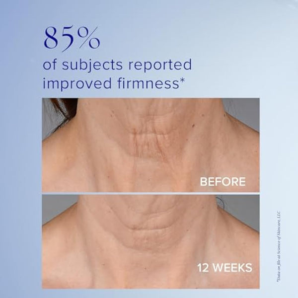 iS CLINICAL Neckperfect Complex, Neck firming cream, Anti-Aging Neck lift, neck tightening cream