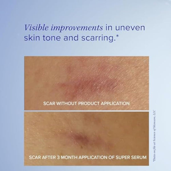 iS CLINICAL Super Serum Advance+ - Anti-Aging Vitamin C Face Serum, Reduces Scaring and Fine Stretch Marks, 1 Fl Oz