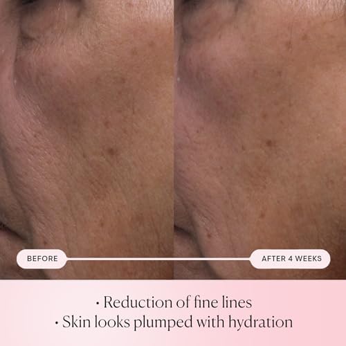 Elemis Pro-Collagen Serums – Renewal, Super Elixir & Rose Micro Serum for Smoother, Firmer, Radiant Skin (15ml & 30ml Anti-Aging Skincare)