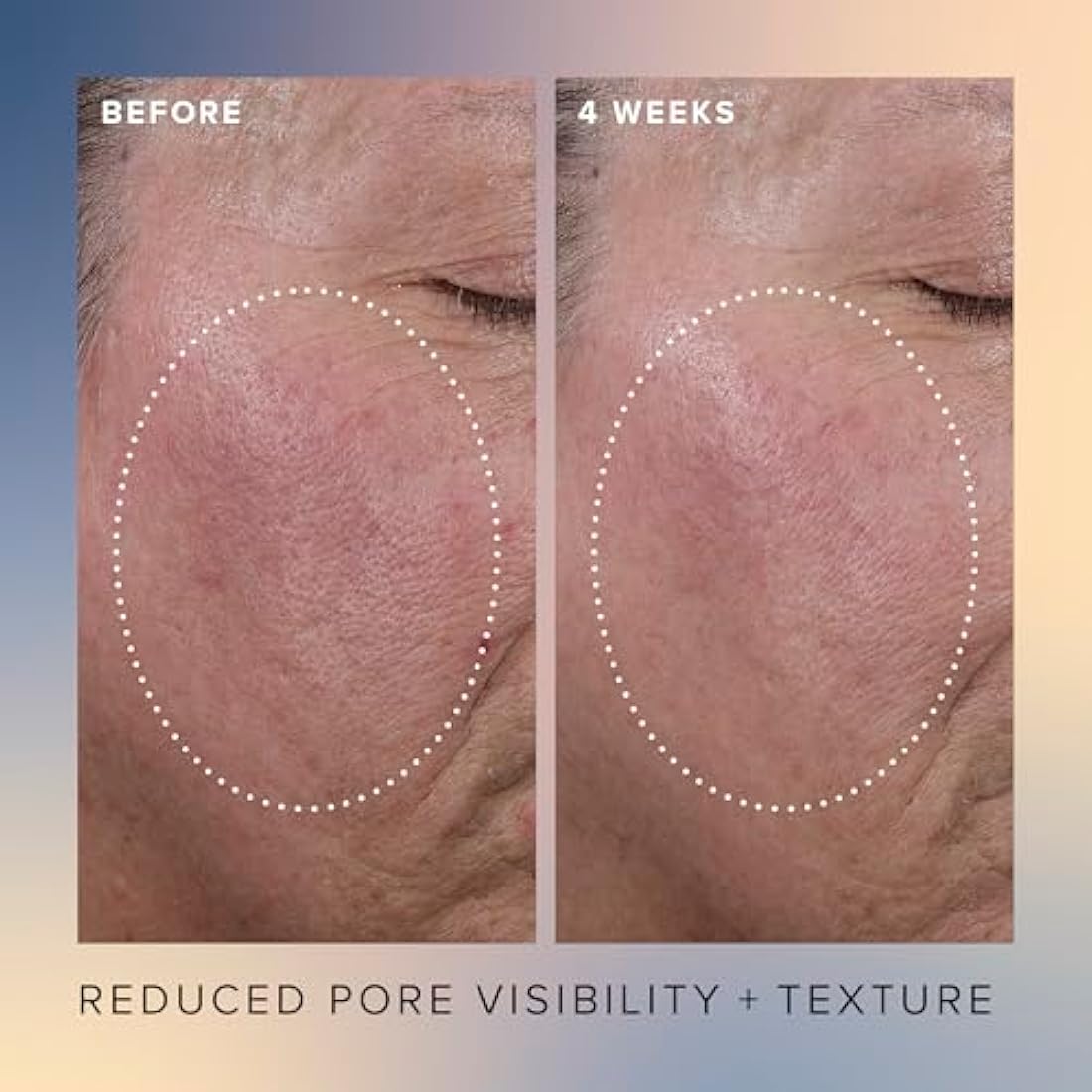 Farmacy Honey Glow 17% AHA & BHA Resurfacing Night Serum - Facial Serum with Hyaluronic Acid - Reduces Fine Lines & Pores(30ml)