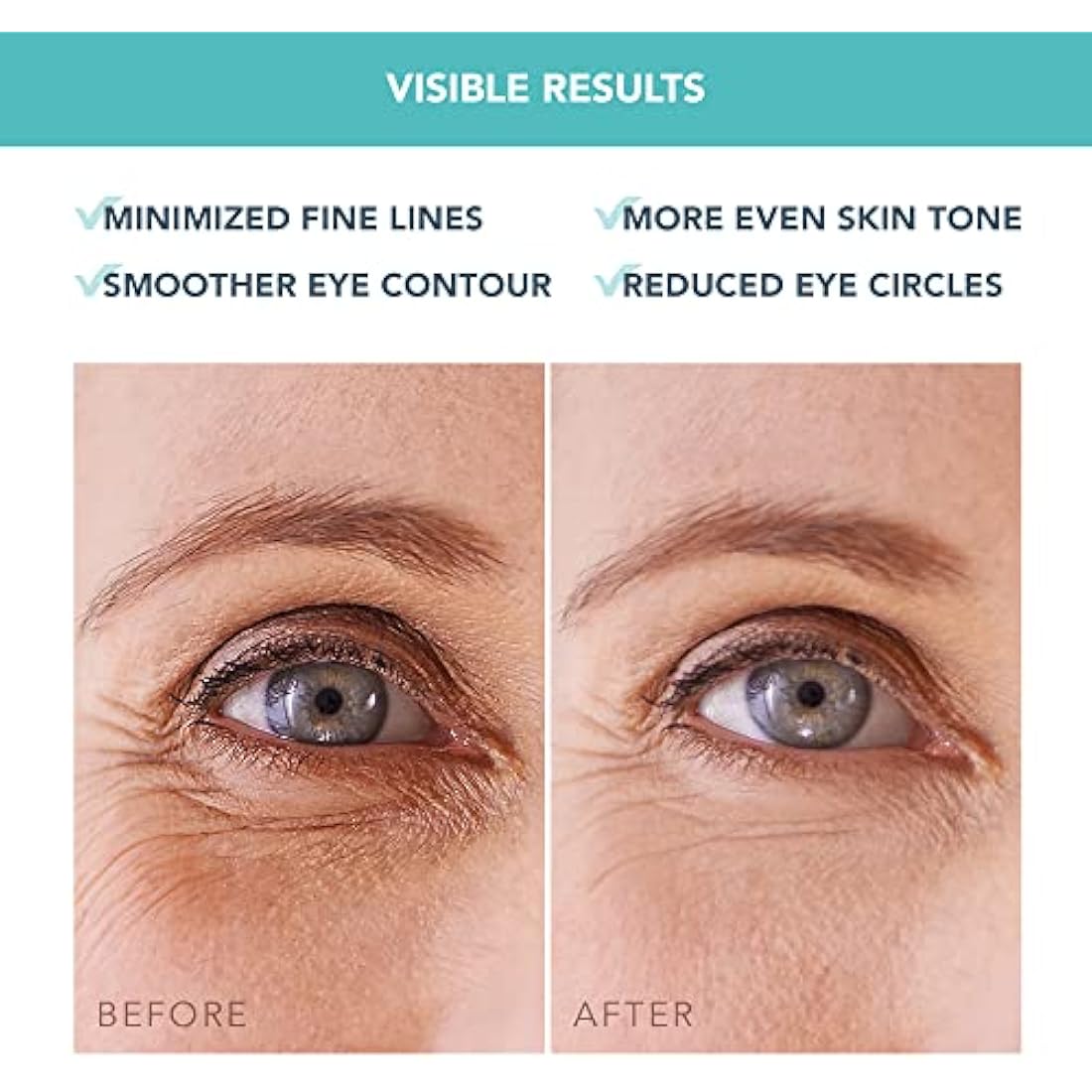 FOREO IRIS Under Eye Gel Patches - Dark Circles Treatment Women & Men - Eye Patches Skincare - Hydrating Gel Mask - Collagen - Vitamin C & Vitamin E - 60 pcs