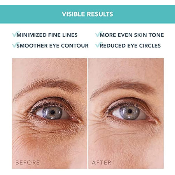 FOREO IRIS Under Eye Gel Patches - Dark Circles Treatment Women & Men - Eye Patches Skincare - Hydrating Gel Mask - Collagen - Vitamin C & Vitamin E - 60 pcs