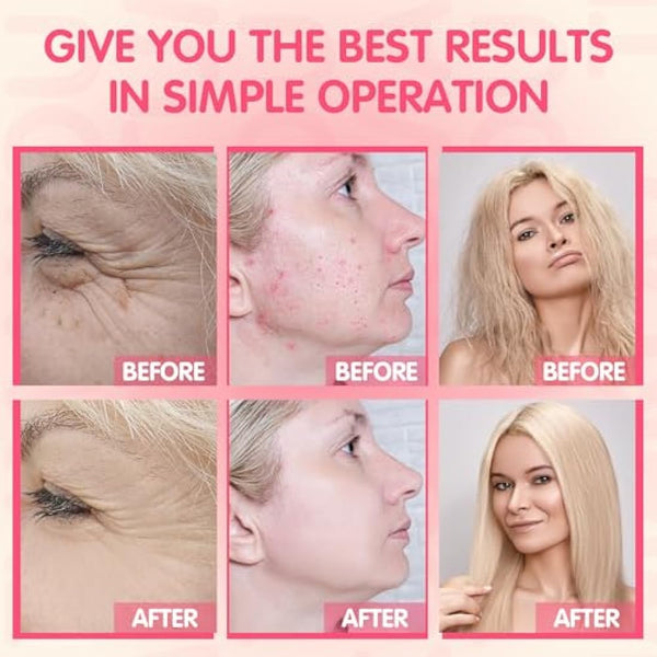 High Frequency Facial Machine - TUMAKOU Neon Portable High Frequency Facial Skin Light Therapy Wand Device with 4 Electrodes for Acne, Wrinkle Removal, Hair Regrowth, Skin Tightening, Anti Aging