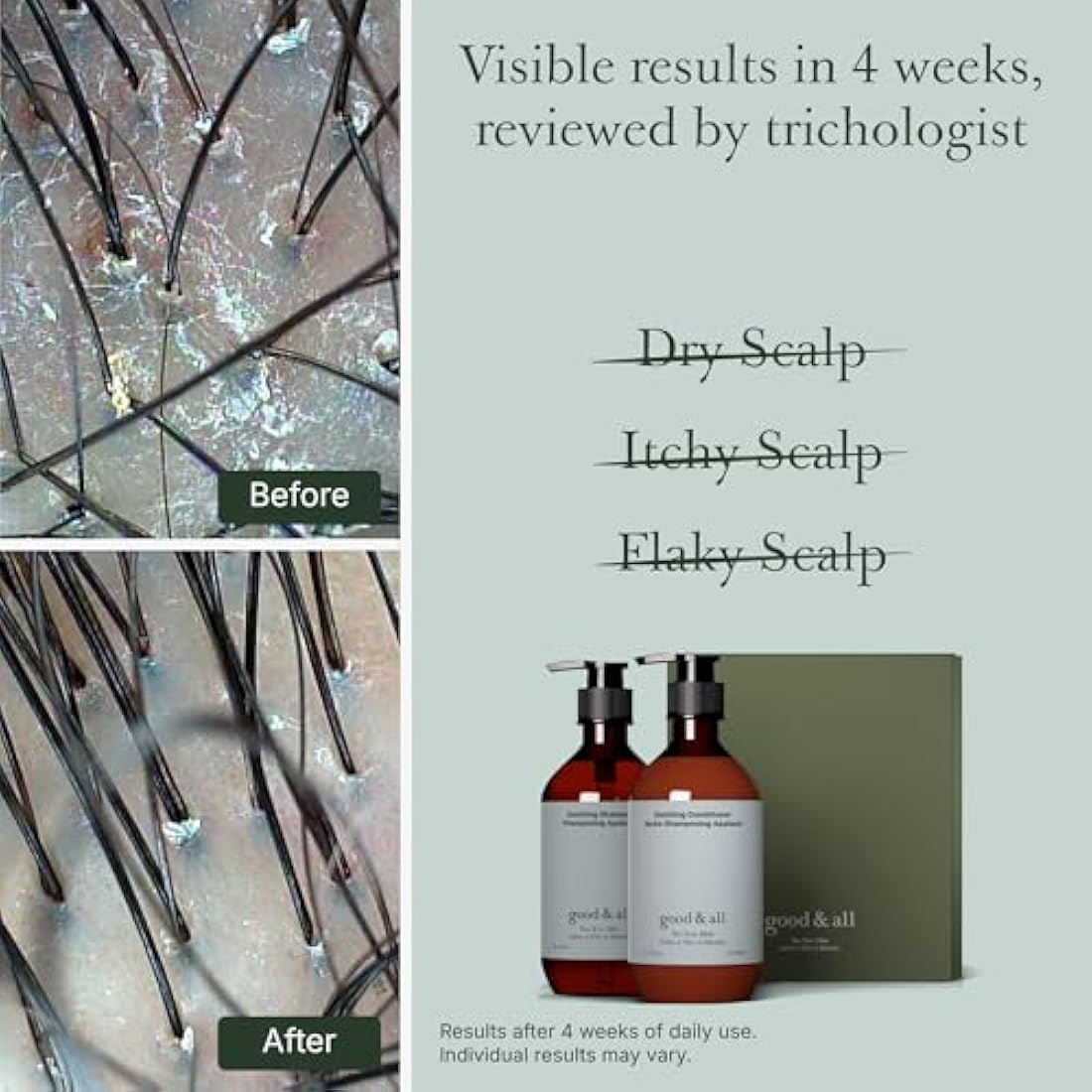 Good&All Tea Tree Shampoo and Conditioner Set for Dry Itchy Scalp with Peppermint - Sodium Lauryl Sulfate/Sulphate, Silicone, Paraben, Fragrance Free - 400ml