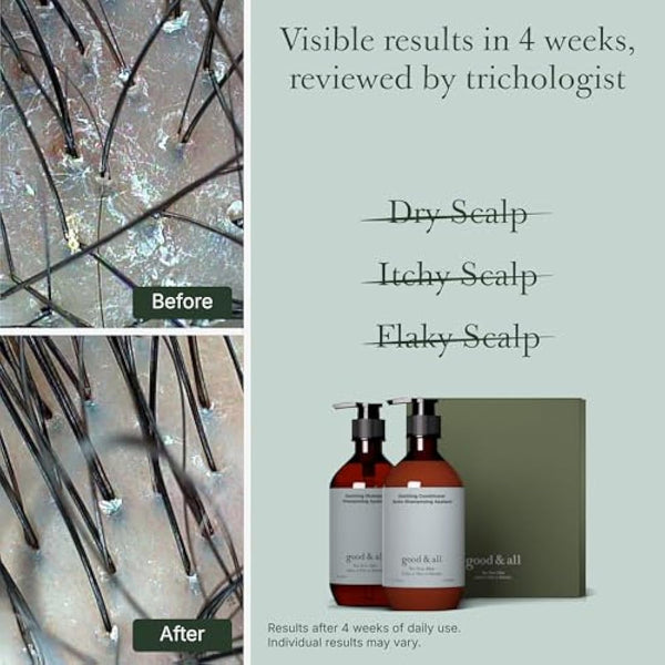 Good&All Tea Tree Shampoo and Conditioner Set for Dry Itchy Scalp with Peppermint - Sodium Lauryl Sulfate/Sulphate, Silicone, Paraben, Fragrance Free - 400ml