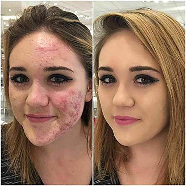 Aquapurity Phoera® Full Coverage Foundation Soft Matte Oil Control Concealer 30ml Flawless Cream Smooth Long Lasting (104 BUFF BEIGE)