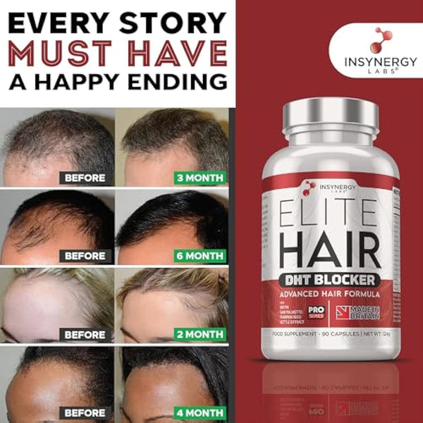 DHT Blocker Elite Hair, Hair Growth Supplement | #1 Advanced Hair Supplements for Women & Men | DHT Blocker Tablets Hair Growth Vitamins | 90 Capsules 16 Ingredients in 1