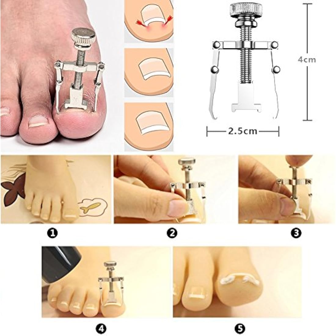 MojiDecor Ingrown Toenail Filae and Ingrowing Toenail File, Professional Nail Care Set 6PCS Premium Stainless Steel Manicure Pedicure Set, Nail Nipper Nail Slider Nail File and Ingrown Toe Tool