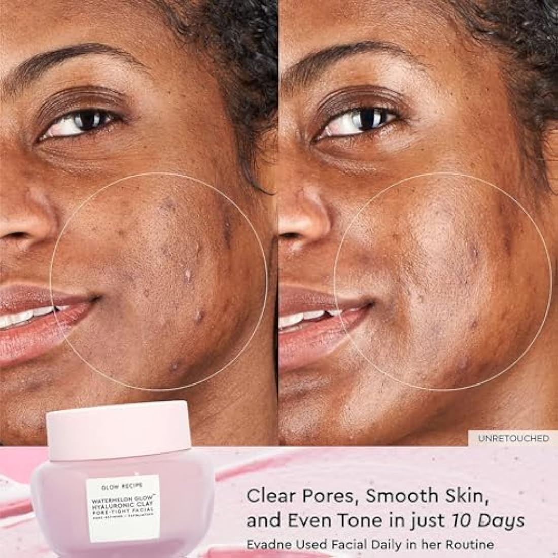 Glow Recipe Watermelon Glow Hyaluronic Clay Pore-Tight Facial - Gentle Exfoliating Clay Mask with Hyaluronic Acid - Help Minimize the Appearance of Pores, Even Tone + Hydrate (60ml / 2oz)