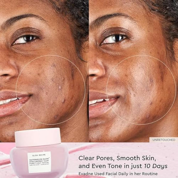 Glow Recipe Watermelon Glow Hyaluronic Clay Pore-Tight Facial - Gentle Exfoliating Clay Mask with Hyaluronic Acid - Help Minimize the Appearance of Pores, Even Tone + Hydrate (60ml / 2oz)