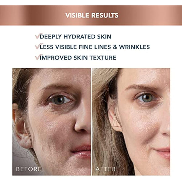 FOREO SUPERCHARGED HA+PGA Triple Action Intense Face Moisturiser - Wrinkle Day Cream for Face - Hyaluronic Acid & Squalane - Vegan - Cruelty & Gluten Free - Clean Skincare - 50ml