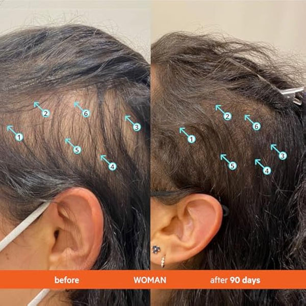 DS Labs Revita Shampoo and Conditioner – High-Performance Hair Density Shampoo & Conditioner, Volumizing & Thickening, Fuller, Healthier-Looking Hair, Sulfate & Silicone Free, For Men & Women, 205mL