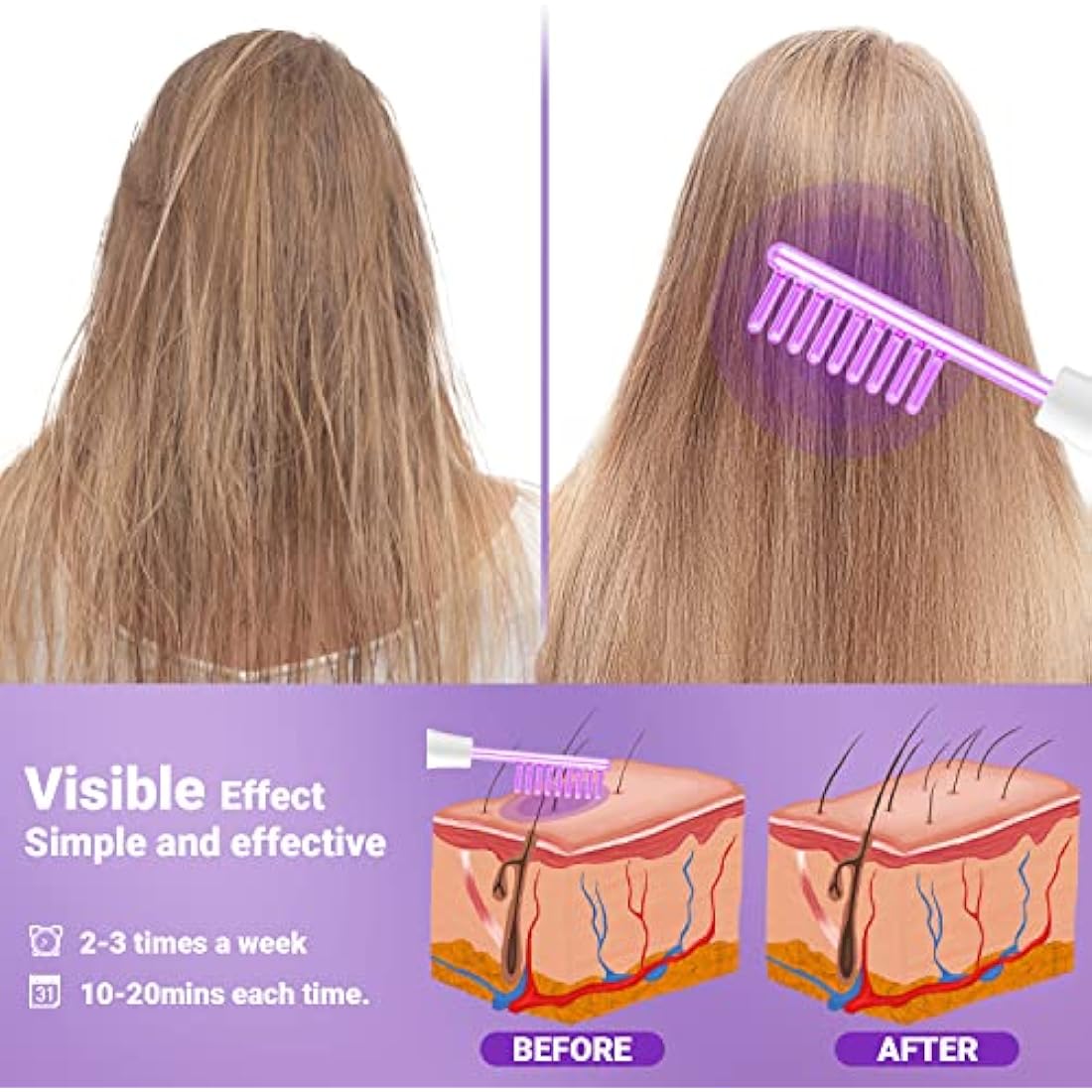 High Frequency Wand - UUPAS Portable Handheld High Frequency Facial Machine Skin Facial Wand with 4 Argon Tubes for Acne Firming Skin Rejuvenation Wrinkle Removal