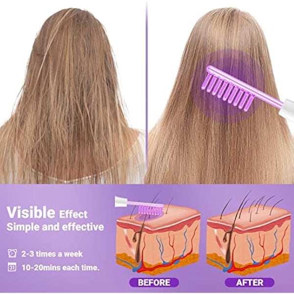 High Frequency Wand - UUPAS Portable Handheld High Frequency Facial Machine Skin Facial Wand with 4 Argon Tubes for Acne Firming Skin Rejuvenation Wrinkle Removal